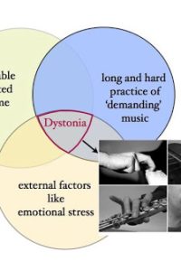 dystonia cause musicians